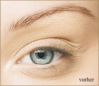 Wimpernlifting vorher